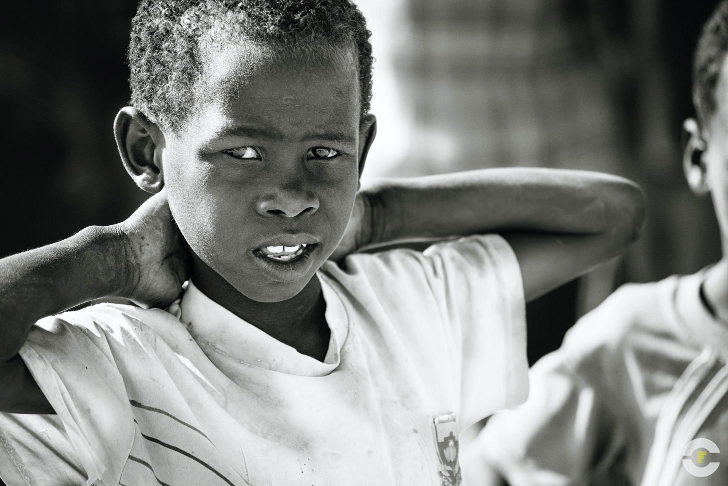 Kenya / Campo de Refugiados Dadaab / 2014